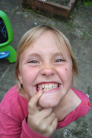 F's missing tooth