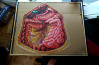 Abdomen puzzle finished!