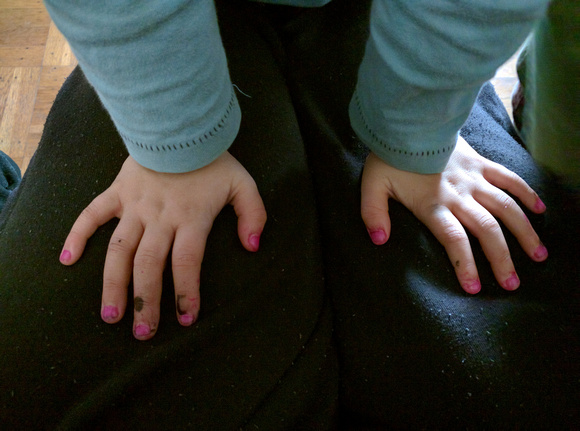 Special nails, unknown child, 1/2