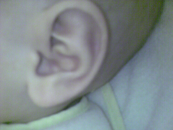 K's weird ear feature that we used as an identifier for the first couple of months.