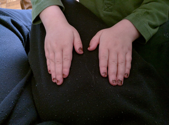 Special nails, unknown child, 2/2